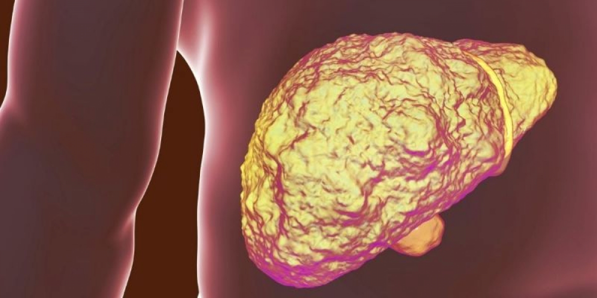 Κίρρωση του Ήπατος