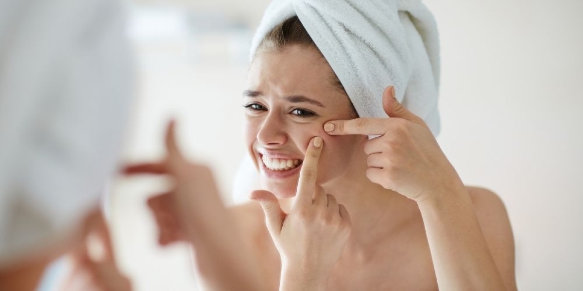 Ακμή: Πως να την αντιμετωπίσεις διατροφικά;