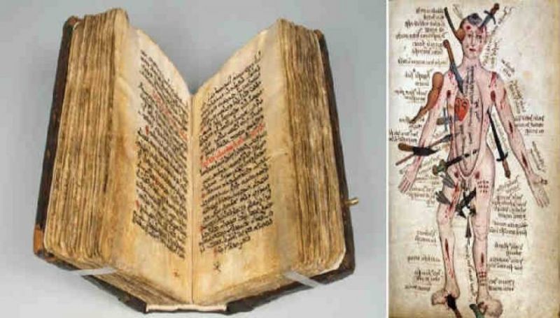 Είναι το Παλίμψηστο του Γαληνού οι θεραπείες των αρχαίων Ελλήνων για όλα τα νοσήματα;