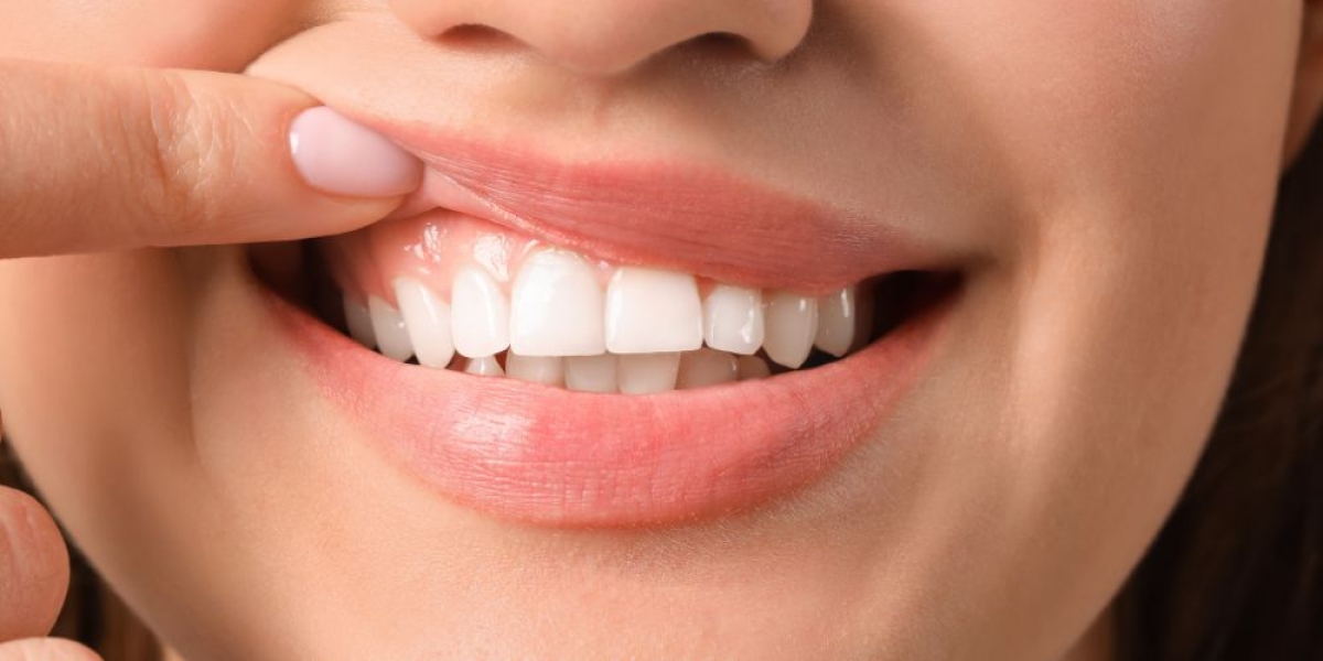 Υγιή Ούλα και Διατροφή [ΟΔΗΓΟΣ]