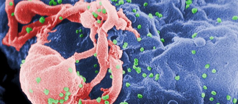 AIDS: Βρέθηκε θεραπεία που εμποδίζει τη μετάδοσή του!