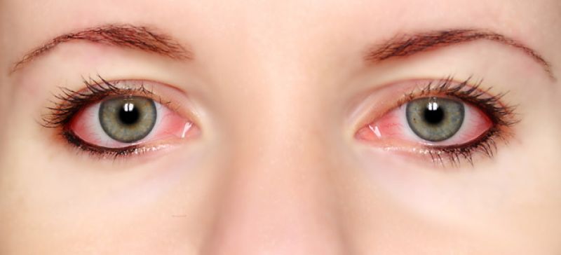 Προσοχή και επιπεφυκίτιδα προκαλεί ο Κορονοϊός