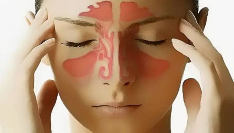 Συμπτώματα και τρόποι αντιμετώπισης της ιγμορίτιδας (φωτό, βίντεο)