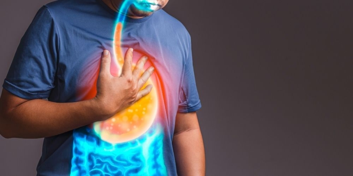 Γαστροοισοφαγική Παλινδρόμηση (ΓΟΠ) και Διατροφική Αντιμετώπιση