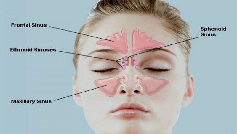 Ιγμορίτιδα: 5 tips για να μπορέσετε να ανακουφιστείτε