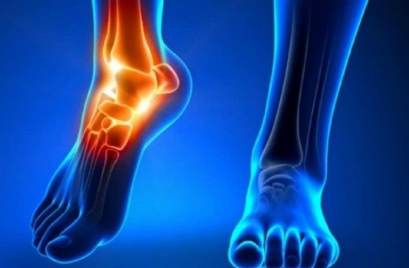 Κάνει θαύματα! Ο χυμός που διαλύει το ουρικό οξύ στις αρθρώσεις