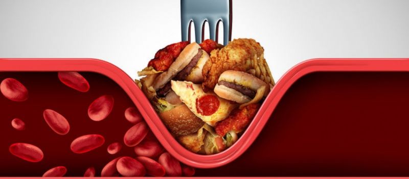 Χοληστερίνη: Αυτές οι τροφές θα «ρίξουν» κατακόρυφα τα νούμερα