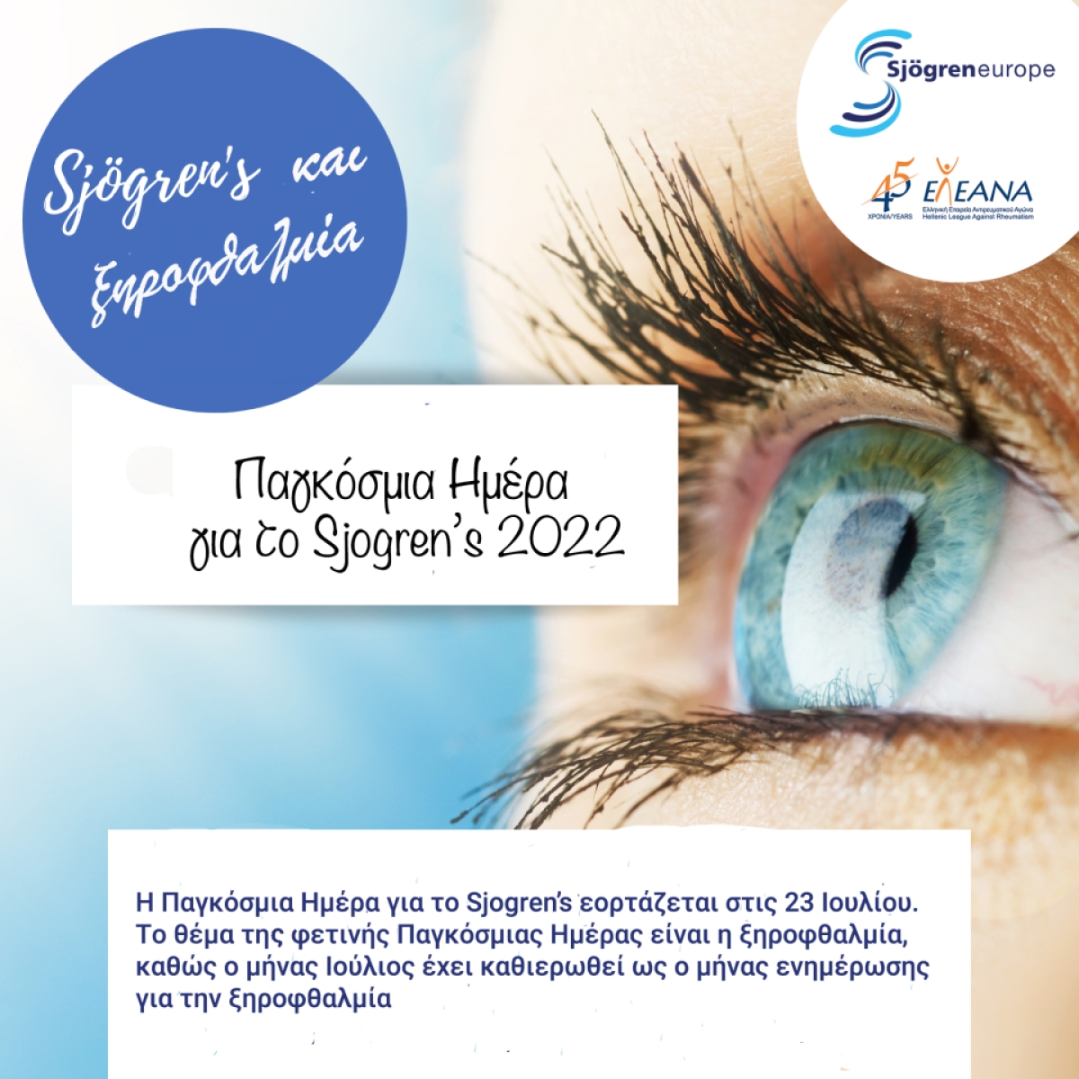 Η ξηροφθαλμία στο Sjögren’s εξακολουθεί να υποδιαγιγνώσκεται  και να υποθεραπεύεται