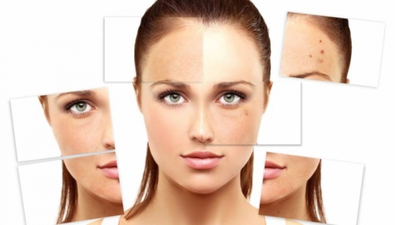 Οι θεραπείες που εξαφανίζουν τις αντιαισθητικές πανάδες από το πρόσωπο