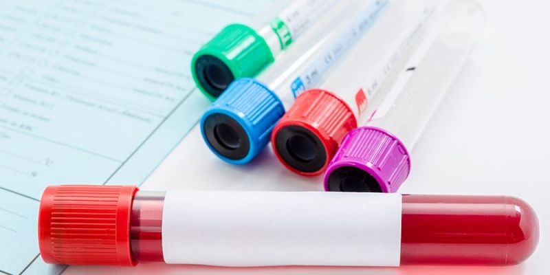 Διατροφικές συμβουλές για επιτυχή αιμοδοσία