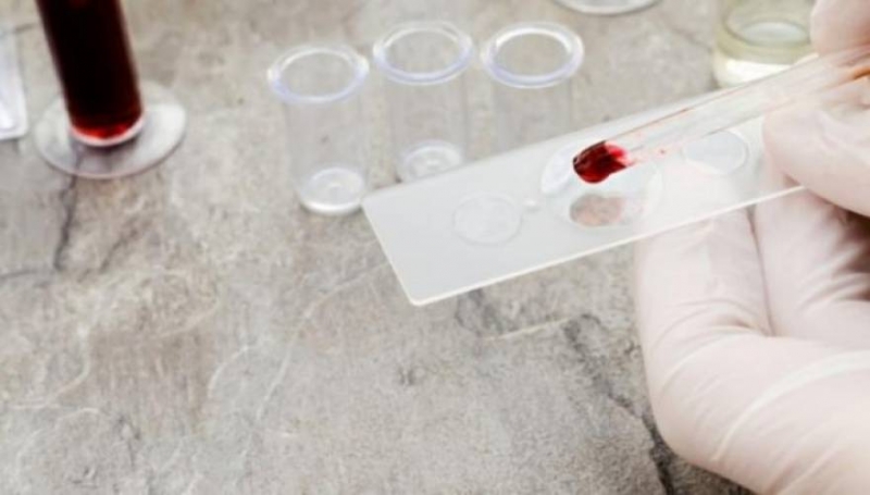 Αυτές είναι οι 7 αιματολογικές εξετάσεις που πρέπει να κάνει κάθε 50άρης!