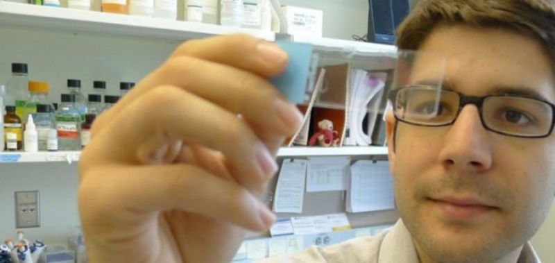 Ο Έλληνας πίσω από σημαντική ανακάλυψη για την έγκαιρη διάγνωση του καρκίνου