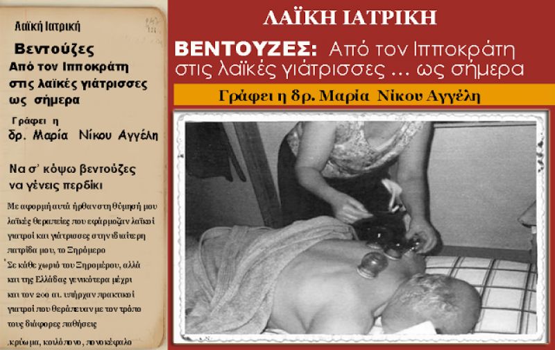 Bεντούζες: Από τον Ιπποκράτη στις λαϊκές γιάτρισσες… ως σήμερα