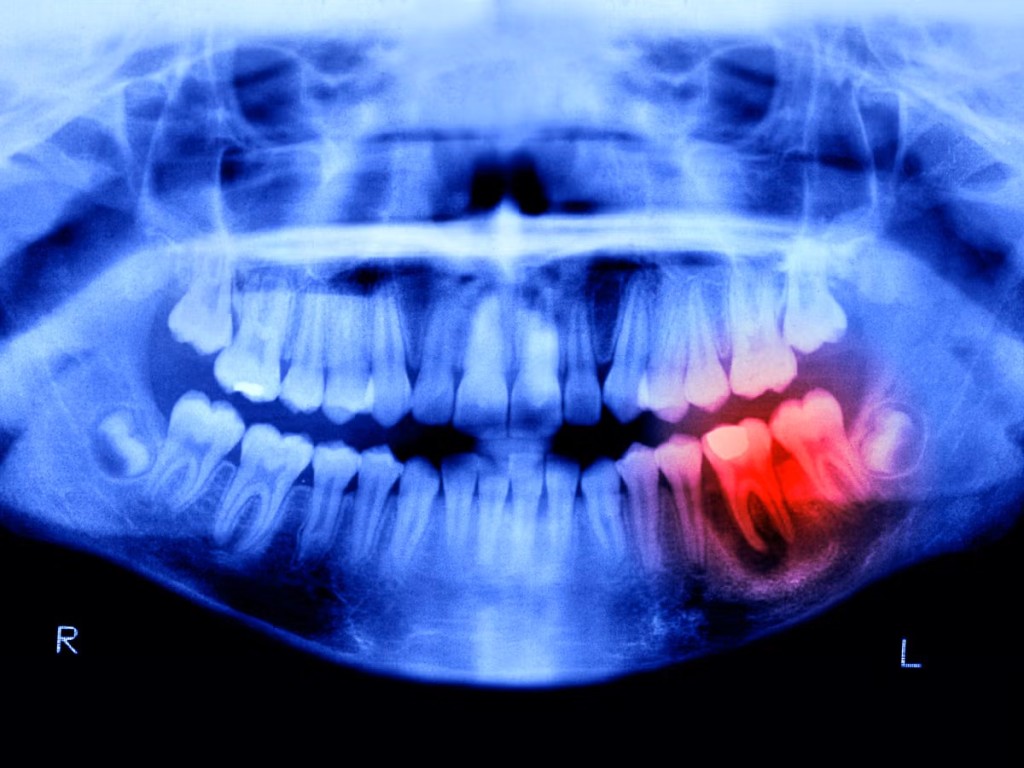 Επανάσταση στην οδοντιατρική: Νοτιοκορεάτες κατάφεραν να φύονται νέα δόντια σε ενήλικες όπως στα μωρά!