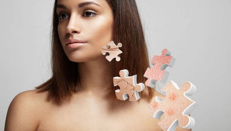 Σημάδια 5 ασθενειών που φαίνονται στο δέρμα