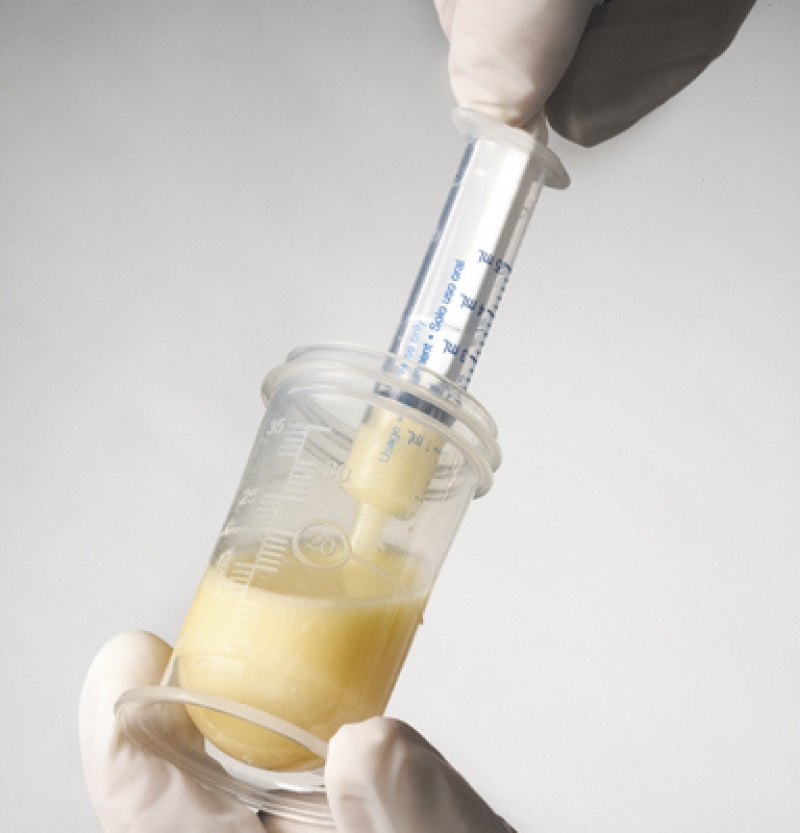 Τα Οφέλη του Colostrum (αλλιώς Πρωτόγαλα) για την υγεία μας