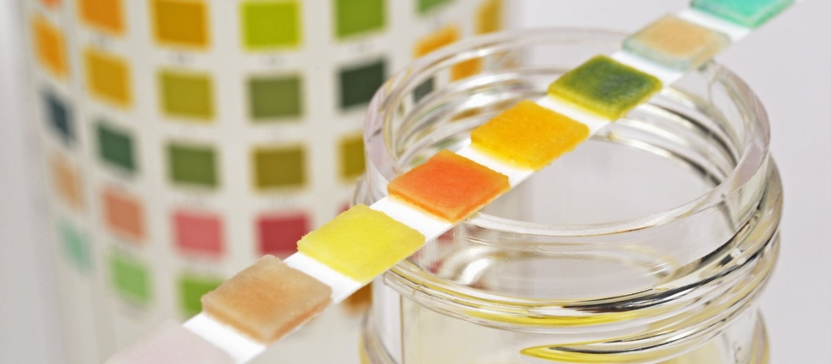 Δείτε τι φανερώνει για την υγεία το χρώμα που έχουν τα ούρα μας