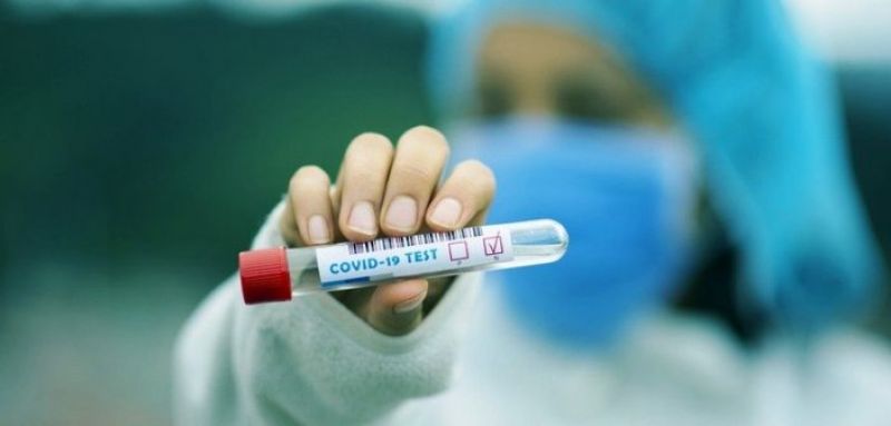 Μπορεί η νικοτίνη να νικήσει τον κορωνοϊό; Δημοσιεύθηκαν χθες οι δύο έρευνες από το Πανεπιστήμιο Πατρών