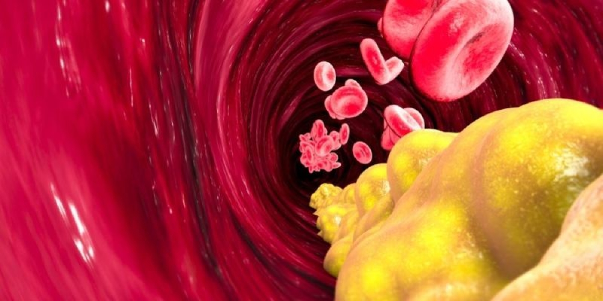 Χοληστερόλη