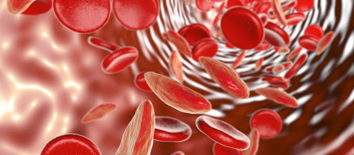 Αναιμία: Έξι φρούτα που βοηθούν στη πρόσληψη σιδήρου και αυξάνουν την παραγωγή αιμοσφαιρίνης