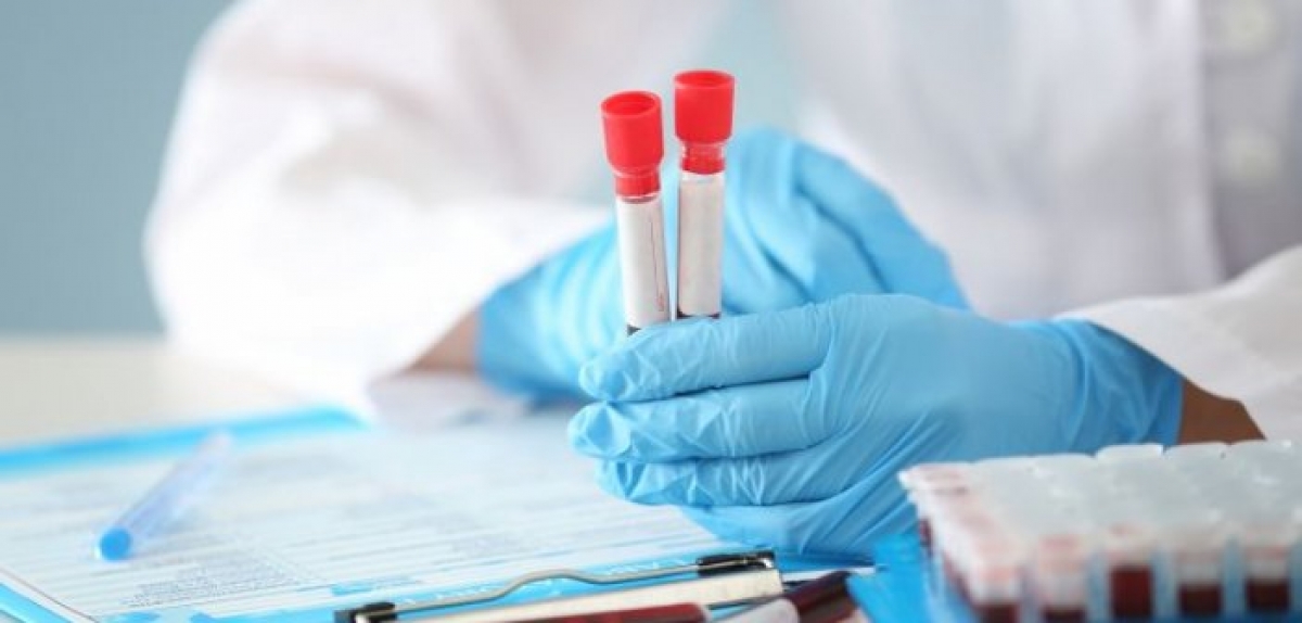 Θρομβώσεις: Τι πρέπει να προσέξετε – Τα προειδοποιητικά σημάδια